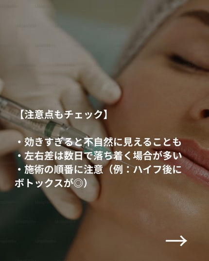 美容ニキ@美容ラボ on LIPS 「#ボトックス#美容医療#エラボトックス..」(5枚目)