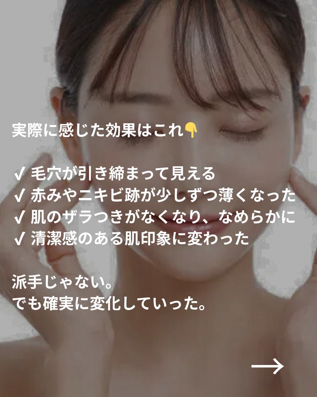 美容ニキ@美容ラボ on LIPS 「#ダーマペン#美容医療 ..」(4枚目)