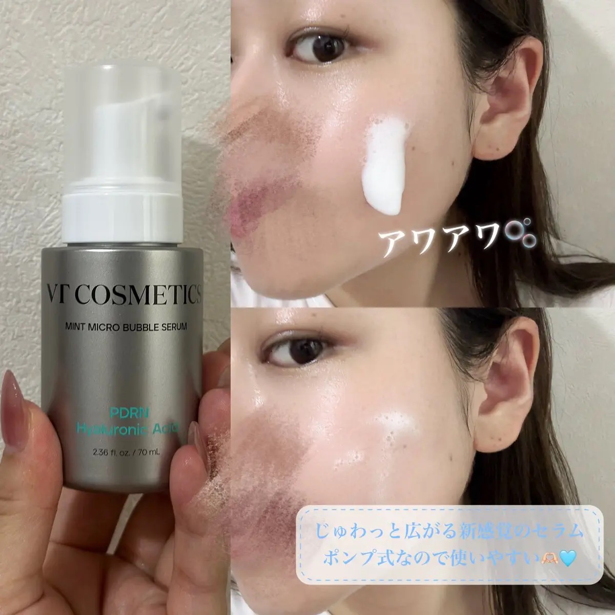 PDRN ヒアルロン酸 ミントマイクロバブルセラム/VT/美容液を使ったクチコミ（2枚目）