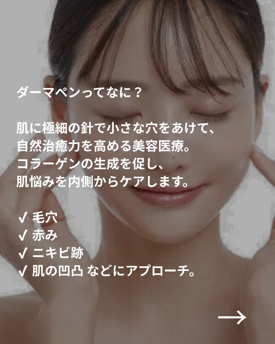 美容ニキ@美容ラボ on LIPS 「#ダーマペン#美容医療 ..」(3枚目)