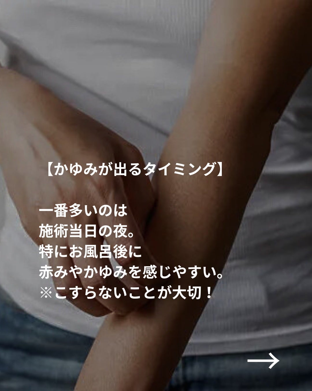 美容ニキ@美容ラボ on LIPS 「#かゆみ対策#脱毛#医療脱毛..」(3枚目)