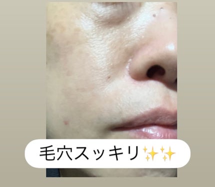 弱酸性毛穴収縮ニドソープ/ODELOI/その他洗顔料を使ったクチコミ(7枚目)