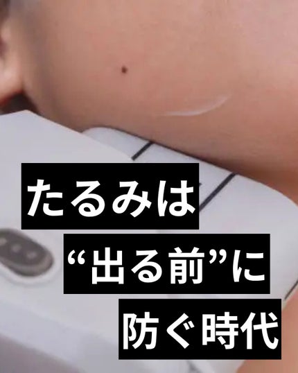 美容ニキ@美容ラボ on LIPS 「#ハイフ#たるみ対策 ..」(1枚目)