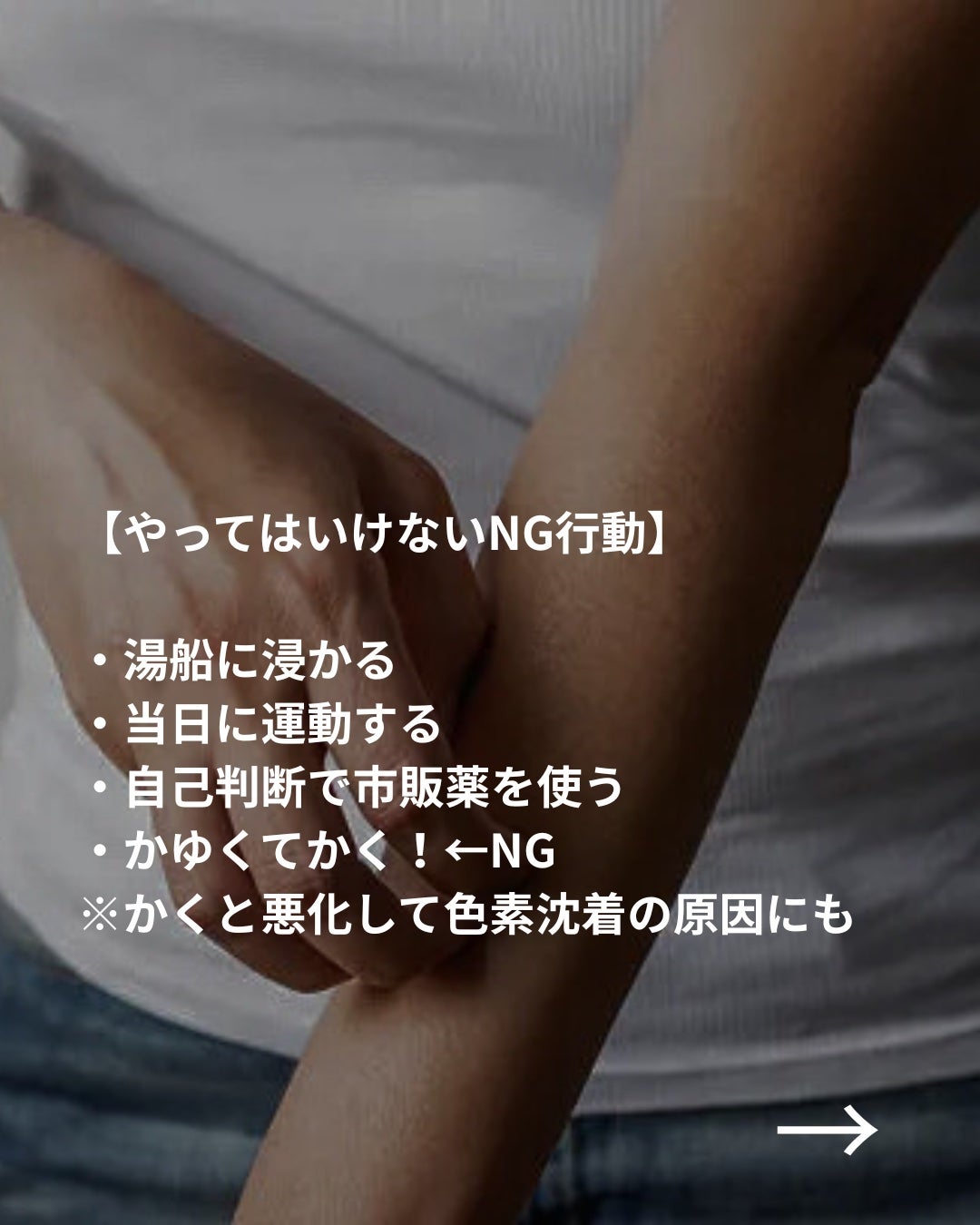 美容ニキ@美容ラボ on LIPS 「#かゆみ対策#脱毛#医療脱毛..」(4枚目)