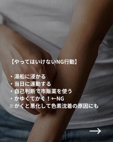 美容ニキ@美容ラボ on LIPS 「#かゆみ対策#脱毛#医療脱毛..」(4枚目)