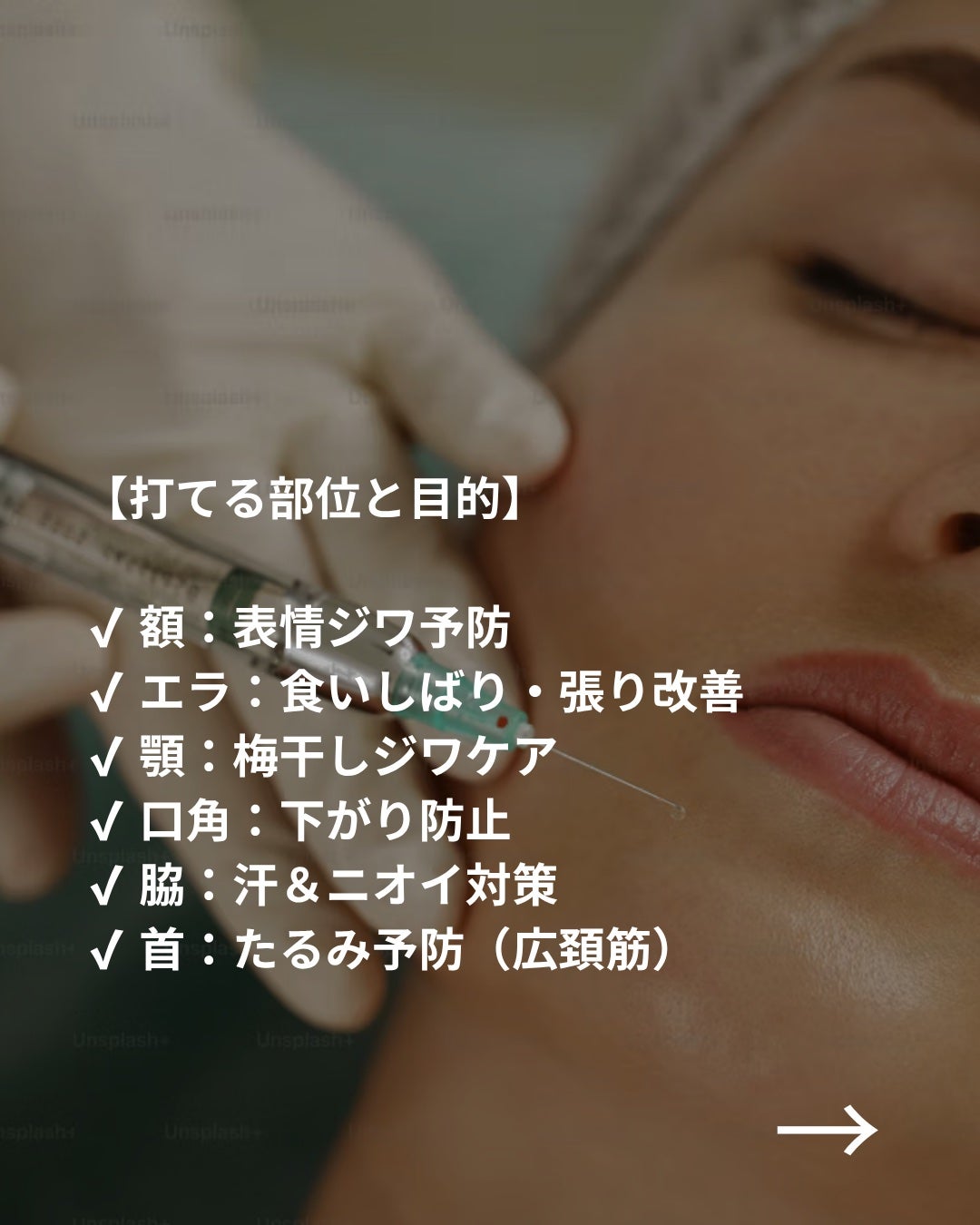 美容ニキ@美容ラボ on LIPS 「#ボトックス#美容医療#エラボトックス..」(3枚目)