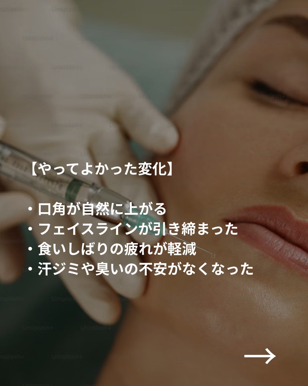 美容ニキ@美容ラボ on LIPS 「#ボトックス#美容医療#エラボトックス..」(4枚目)