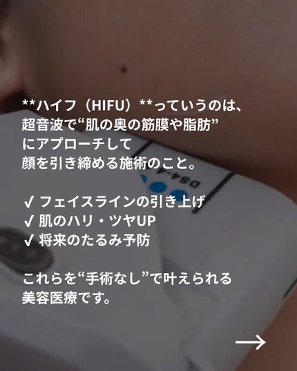 美容ニキ@美容ラボ on LIPS 「#ハイフ#たるみ対策 ..」(3枚目)