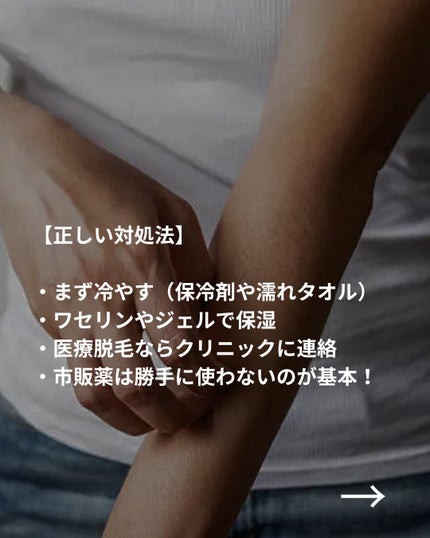 美容ニキ@美容ラボ on LIPS 「#かゆみ対策#脱毛#医療脱毛..」(5枚目)