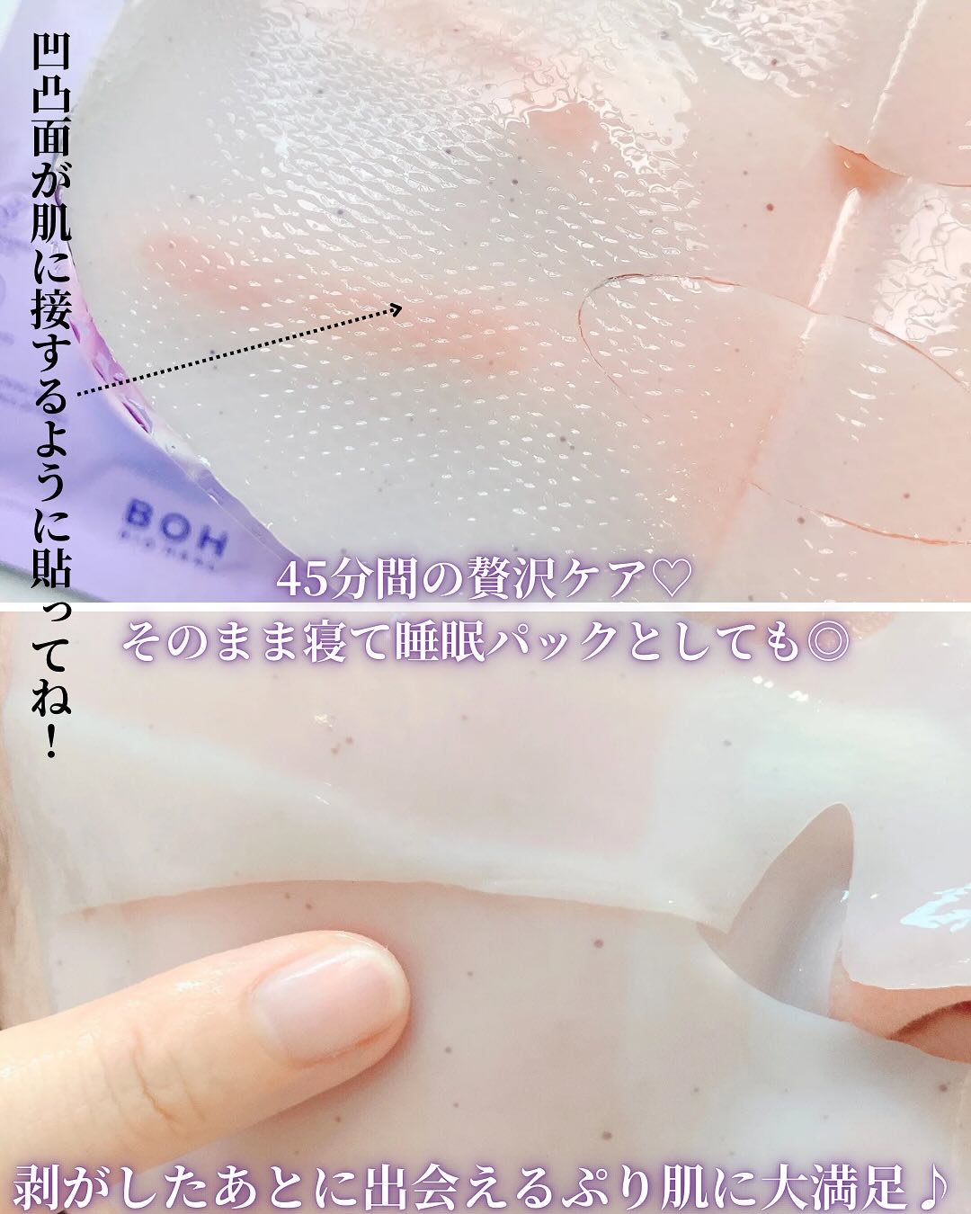 バイオヒールボ プロバイオダーム™ コラーゲンリモデリングゲルマスク/BIOHEAL BOH/シートマスク・パックを使ったクチコミ（3枚目）