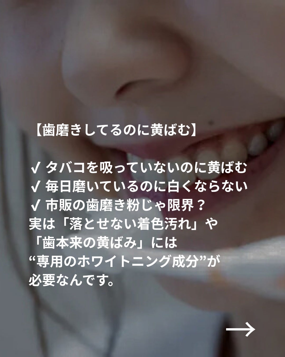 アパガードプレミオ/アパガード/歯磨き粉を使ったクチコミ(3枚目)