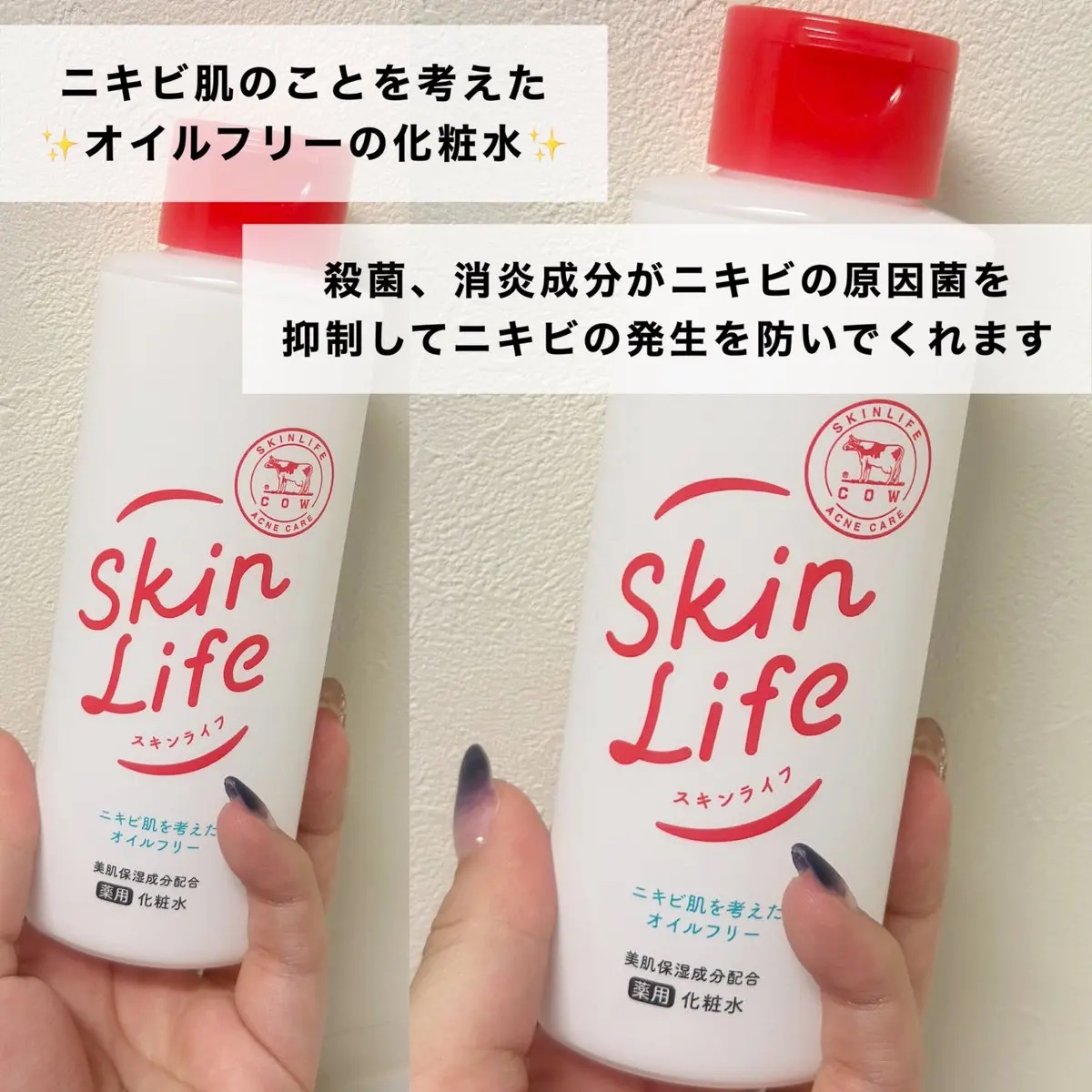 薬用化粧水/スキンライフ/化粧水を使ったクチコミ（2枚目）