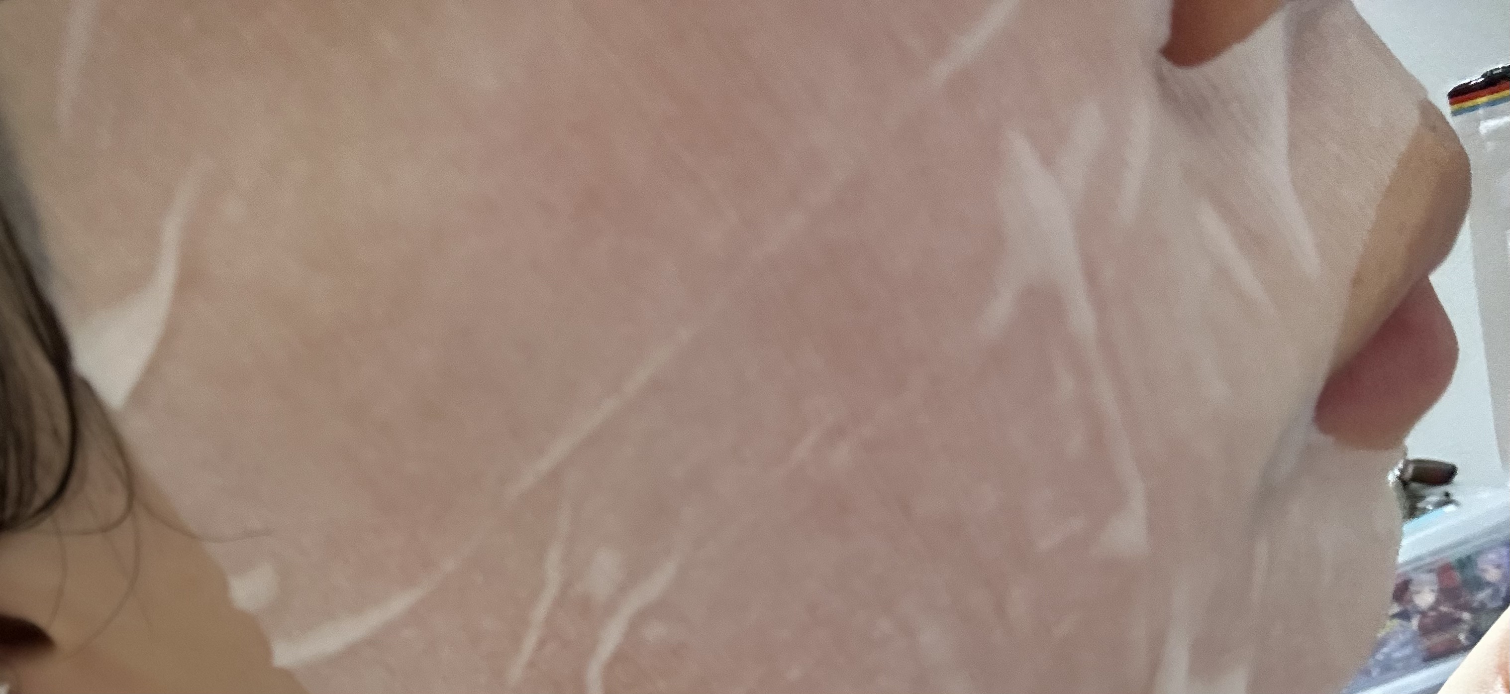 CHOI薬用マスク ニキビケア ［医薬部外品］/肌美精/シートマスク・パックを使ったクチコミ（3枚目）