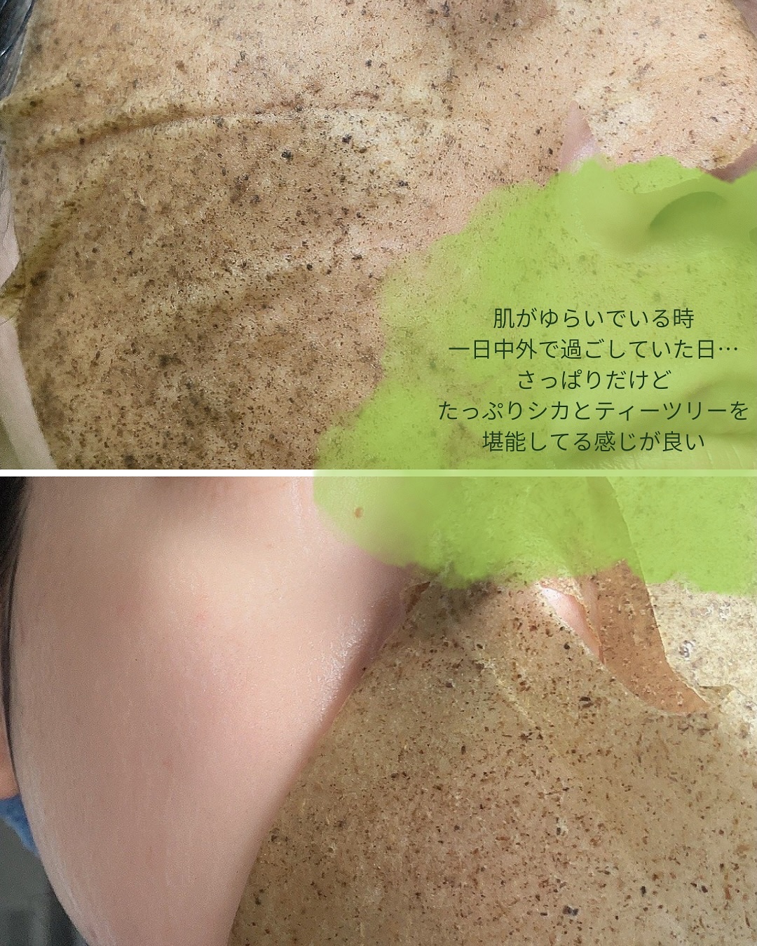 ティーツリーハーブシカマスクパック/WellDerma/シートマスク・パックを使ったクチコミ（3枚目）