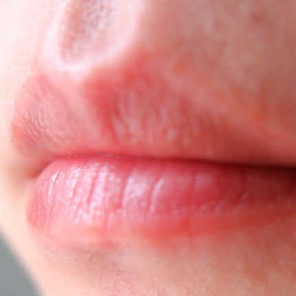 エテルナムリップセラム /エテルナム/リップ美容液を使ったクチコミ(3枚目)