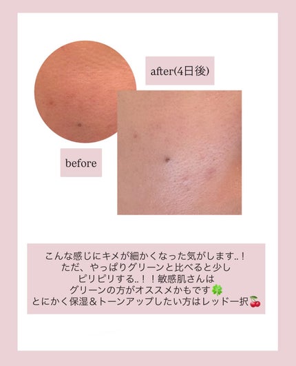 レッドモチセラム30/アレンシア/美容液を使ったクチコミ(4枚目)