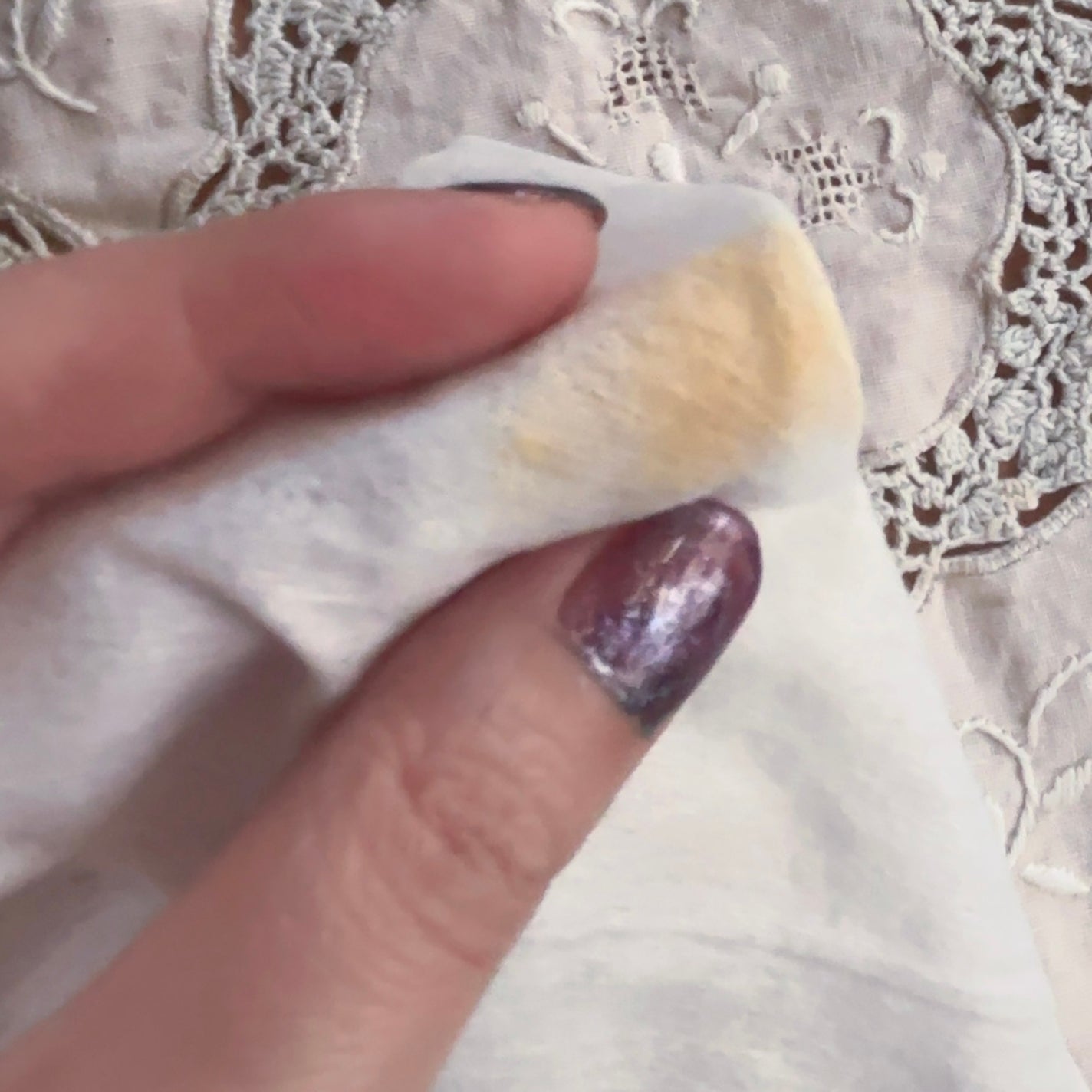 アヌア ビタミンC20 ブレミッシュセラム/Anua/美容液を使ったクチコミ(4枚目)