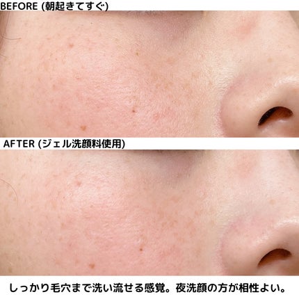 おうちdeエステ 肌をなめらかにする マッサージ洗顔ジェル/ビオレ/その他洗顔料を使ったクチコミ(4枚目)