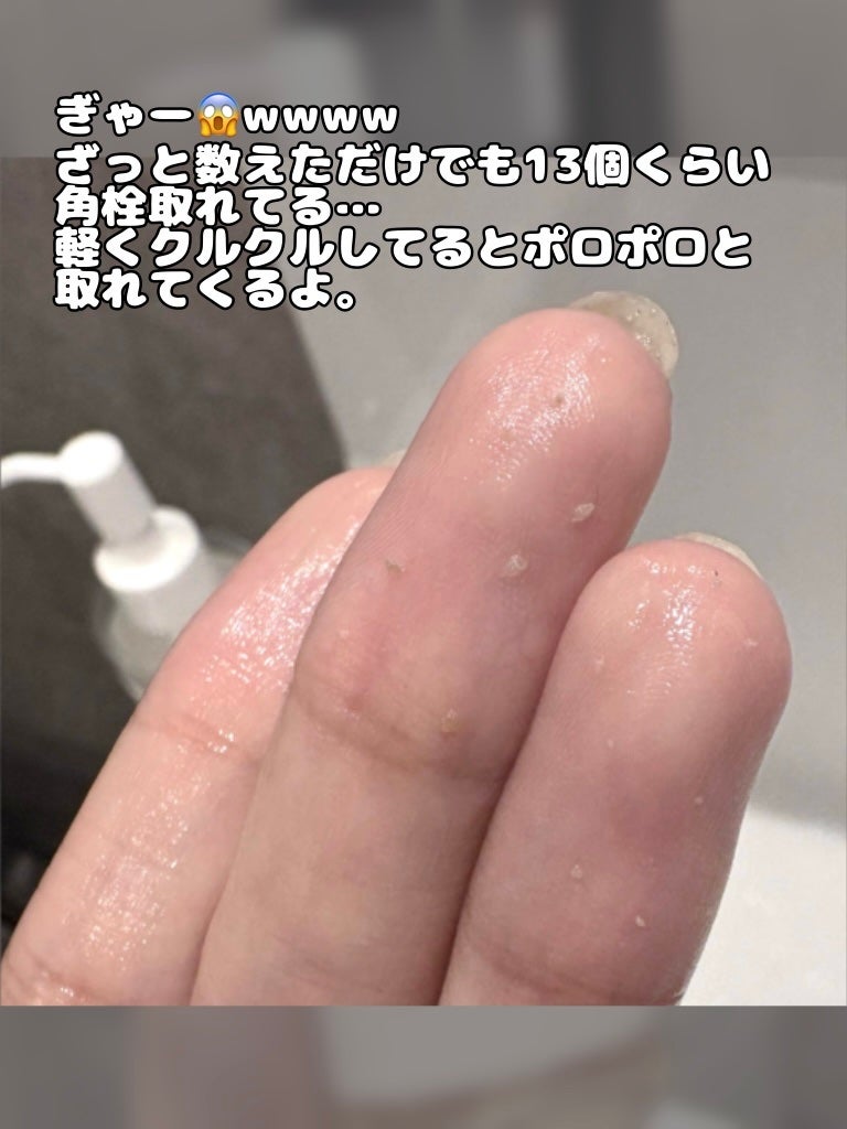 ドクダミ ポアコントロールクレンジングオイル/Anua/オイルクレンジングを使ったクチコミ(3枚目)