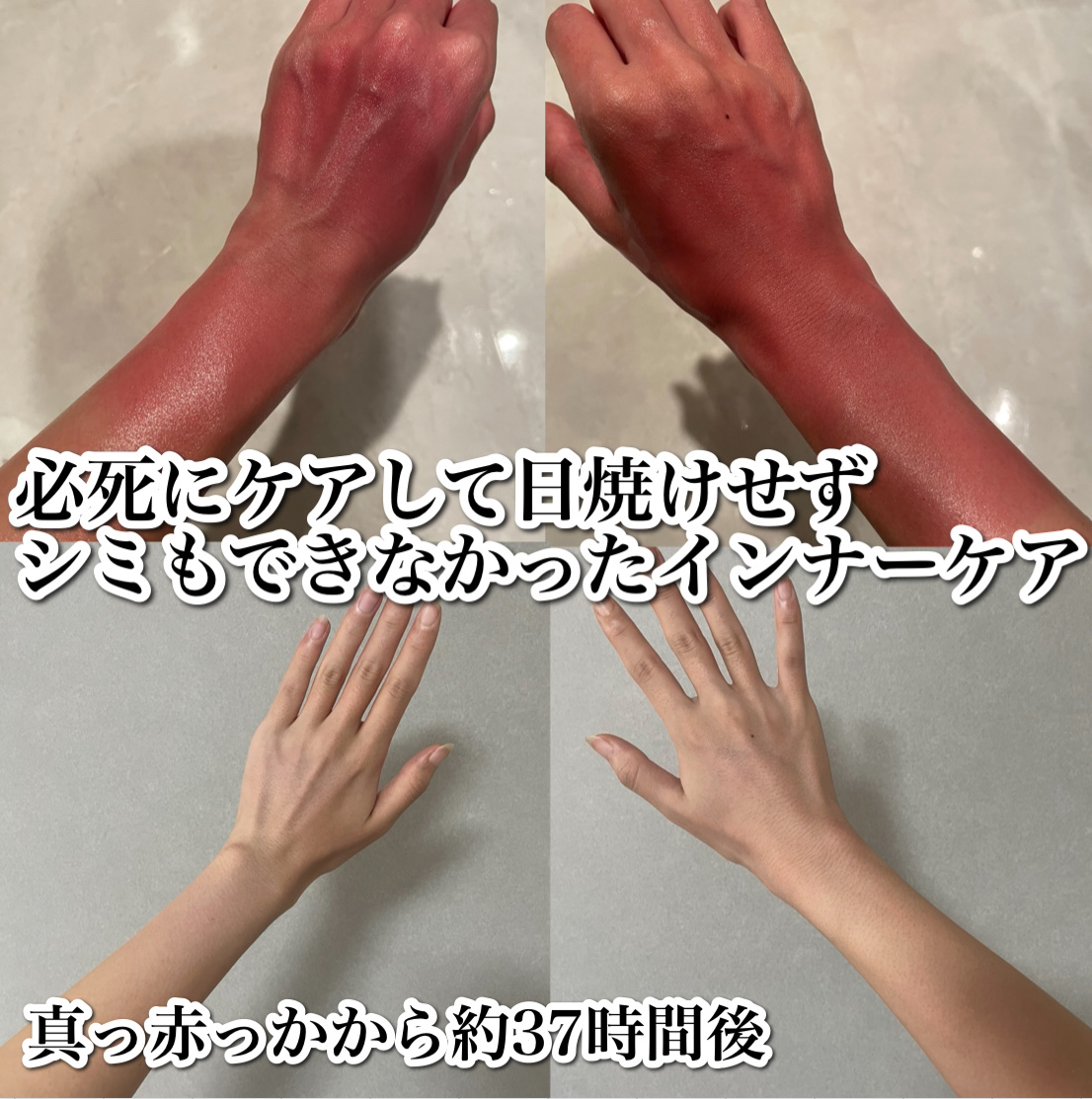 カラーシナジー/オルビス/美容サプリメントを使ったクチコミ（1枚目）