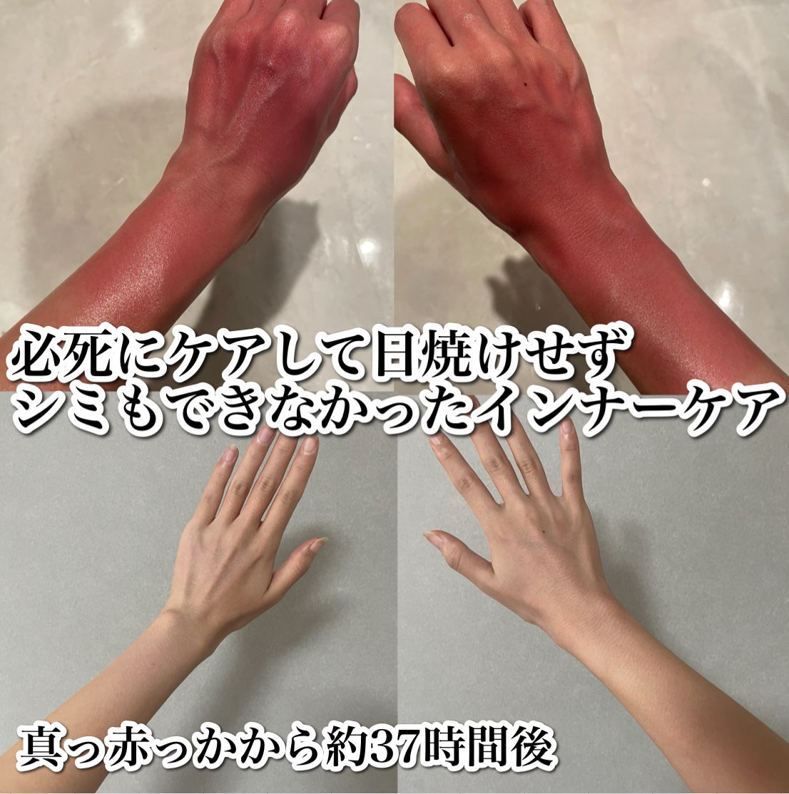 コラーゲンゼリー/オルビス/美容ドリンクを使ったクチコミ(1枚目)