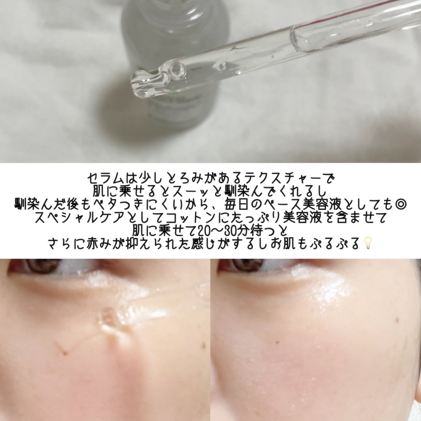 ノスカナイン トラブル セラム/FATION/美容液を使ったクチコミ(4枚目)