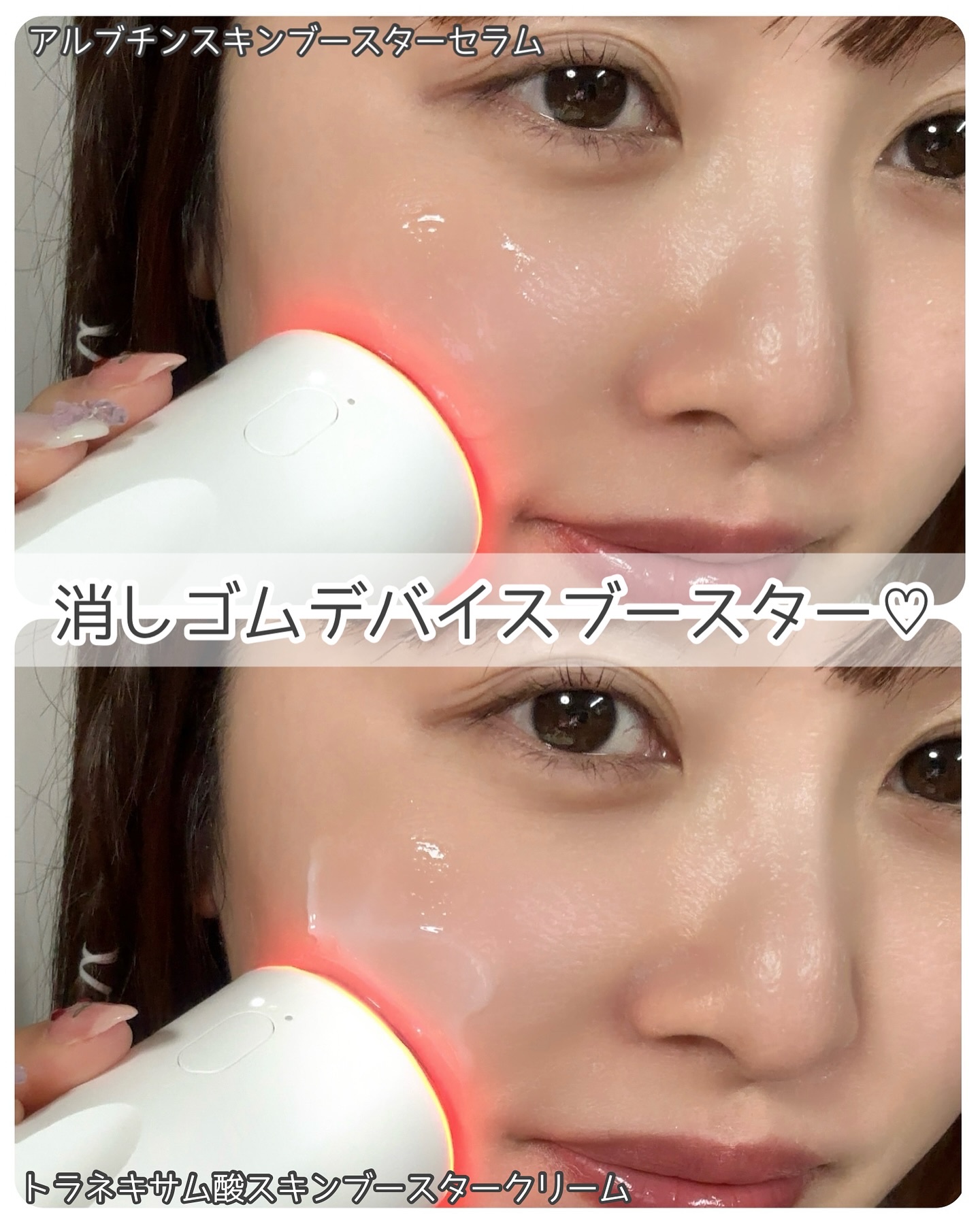 トラネキサム酸スキンブースタークリーム/MEDITHERAPY/フェイスクリームを使ったクチコミ（2枚目）