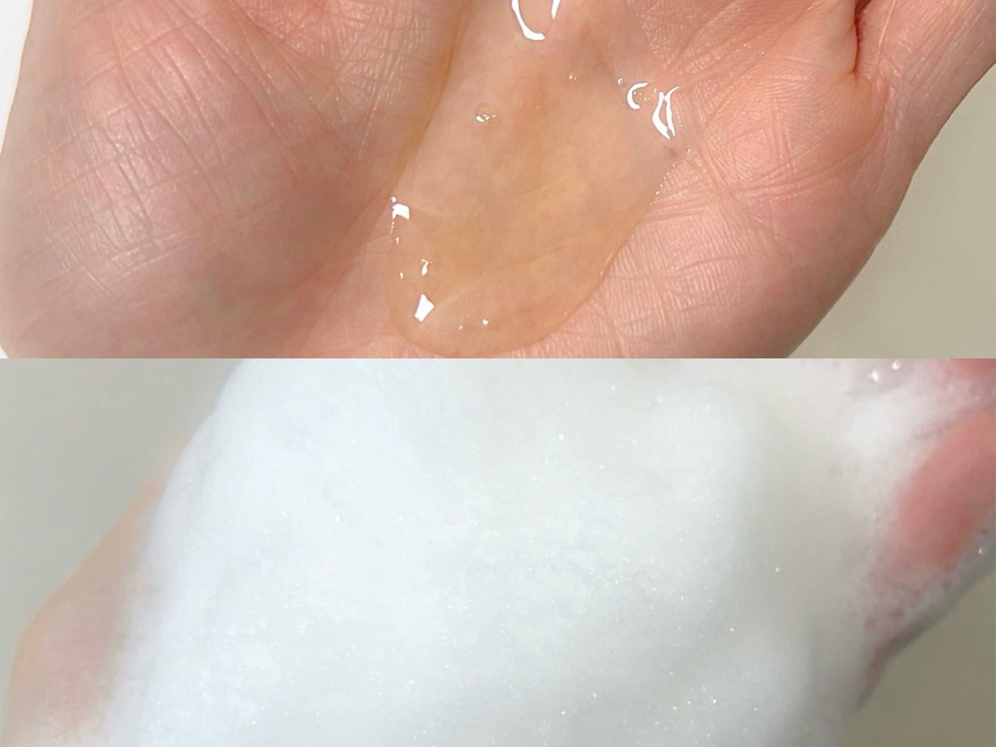 アクネコントロールジェルクレンザー/Celladix/洗顔フォームを使ったクチコミ(2枚目)