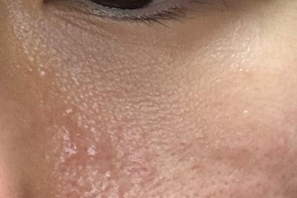 アイファルトアイバッククリーム/Dr.Melaxin/アイケア・アイクリームを使ったクチコミ(4枚目)