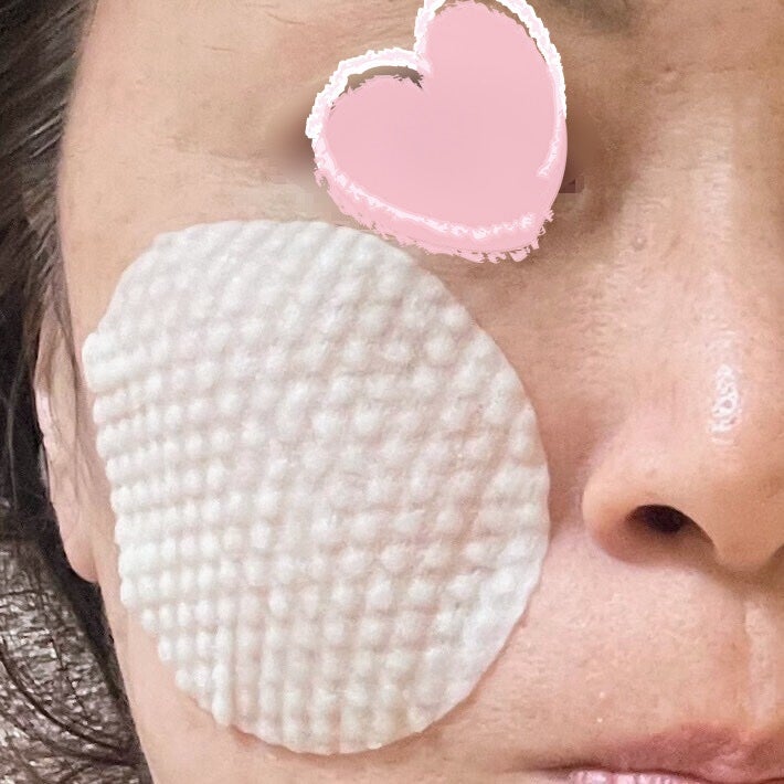 アゼライン酸 トナーパッド/LEPOREM/トナーパッドを使ったクチコミ(6枚目)