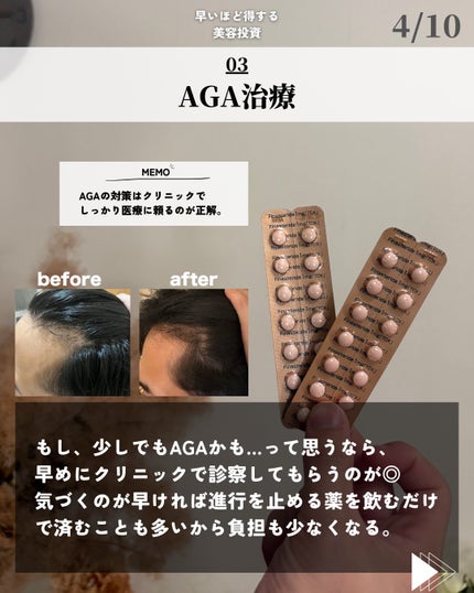 ほづ|メンズ美容で清潔感を上げる on LIPS 「@mens_biyou_hozu←1.5倍カッコ良くなるメンズ..」(4枚目)