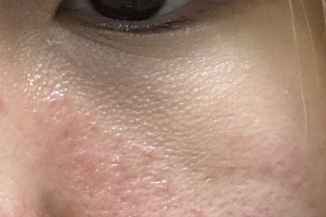 アイファルトアイバッククリーム/Dr.Melaxin/アイケア・アイクリームを使ったクチコミ（2枚目）