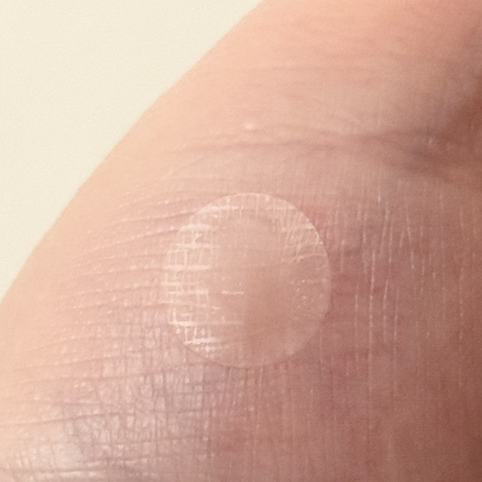 ビタユースビタミンスポットパッチ/ELT COSMETICS/にきびパッチを使ったクチコミ（3枚目）