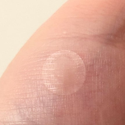 ビタユースビタミンスポットパッチ/ELT COSMETICS/にきびパッチを使ったクチコミ(3枚目)