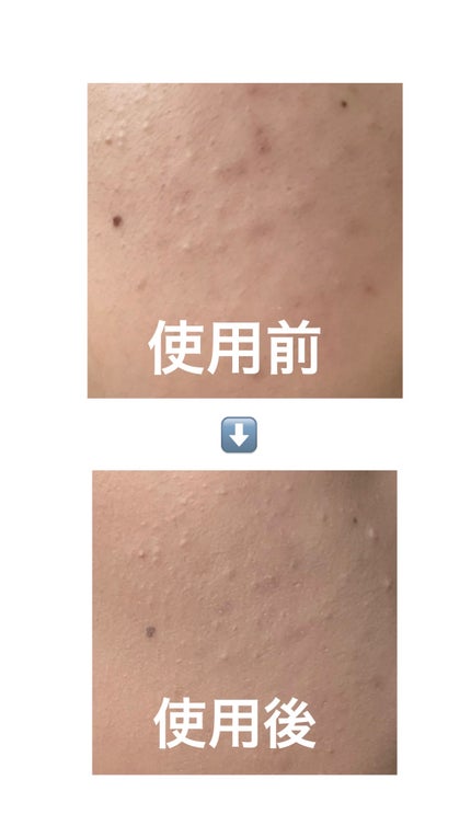 フィー クッションガラス ナチュラル/fwee/クッションファンデーションを使ったクチコミ(2枚目)