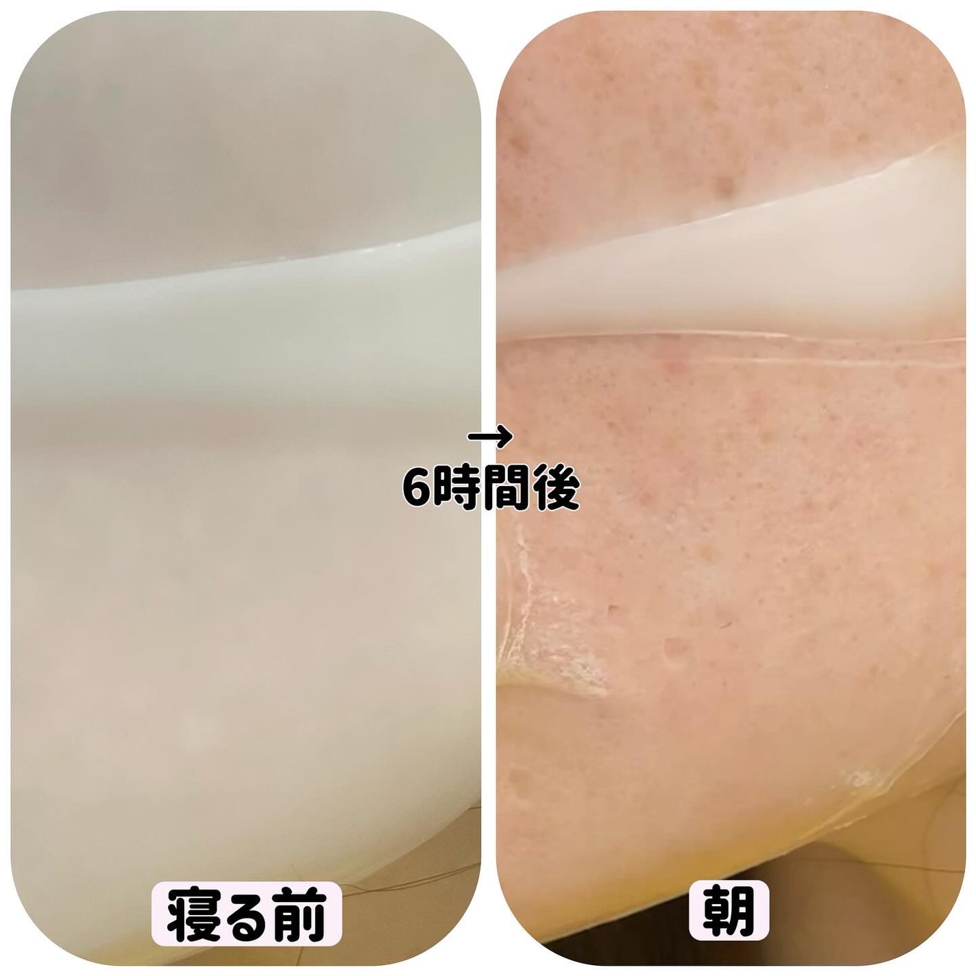 バイオコラーゲンリアルディープマスク/Biodance/シートマスク・パックを使ったクチコミ(3枚目)