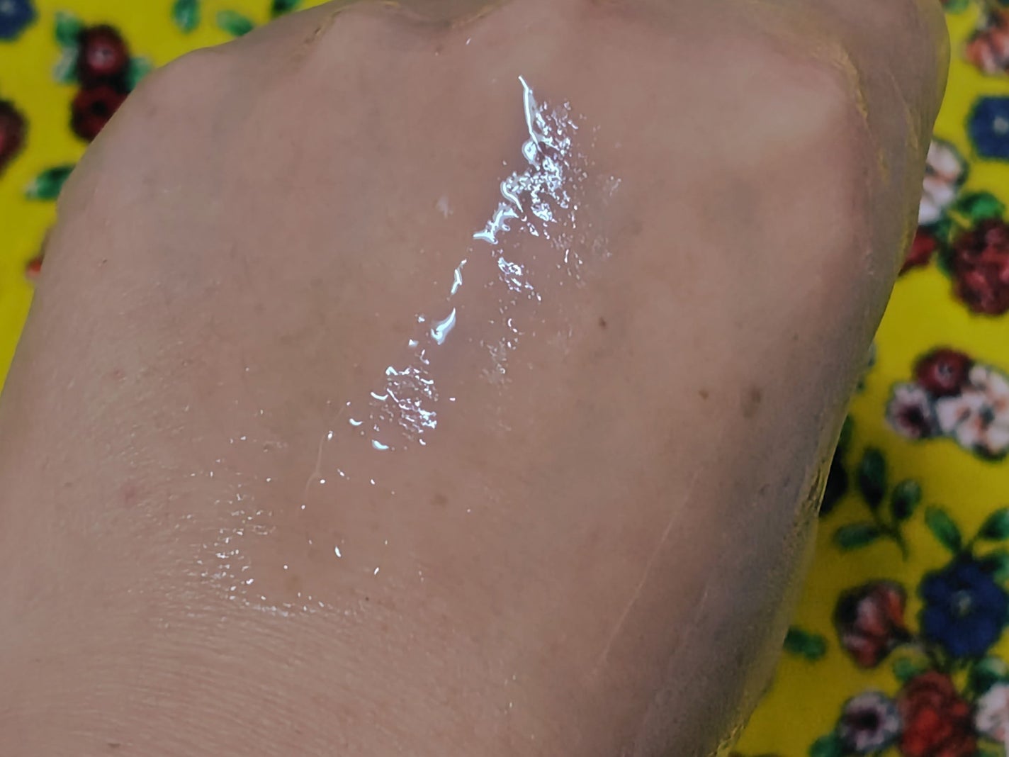 薬用 リペア ローション/アクネオ/化粧水を使ったクチコミ(4枚目)