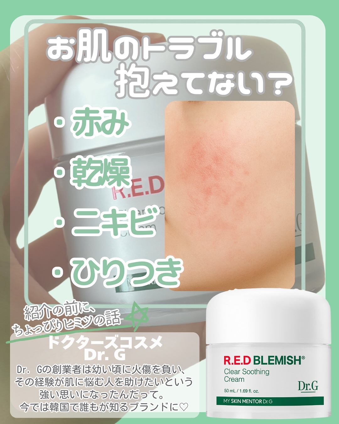 レッドブレミッシュ クリアスージングクリーム/Dr.G/フェイスクリームを使ったクチコミ（2枚目）