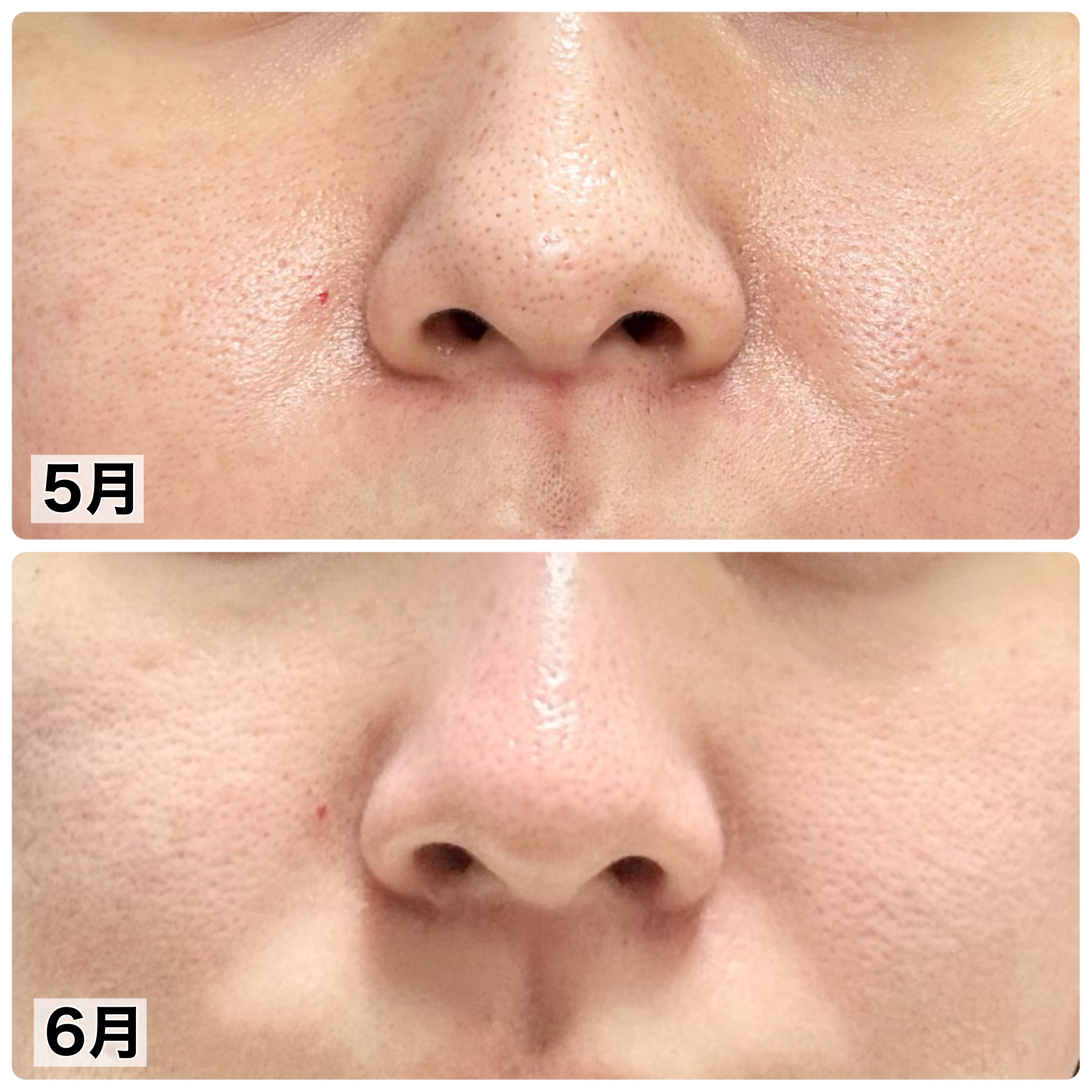 PHセンシティブクリームチューブ 60ml/SAM'U/フェイスクリームを使ったクチコミ（2枚目）