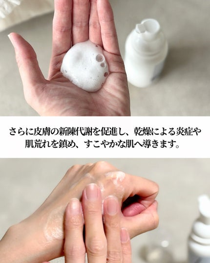 へパロイド泡フォーム(第2類医薬品)/DISM/フェイスクリームを使ったクチコミ(5枚目)