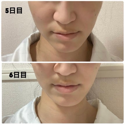 ReFa CARAT/ReFa/ボディケア美容家電を使ったクチコミ(4枚目)