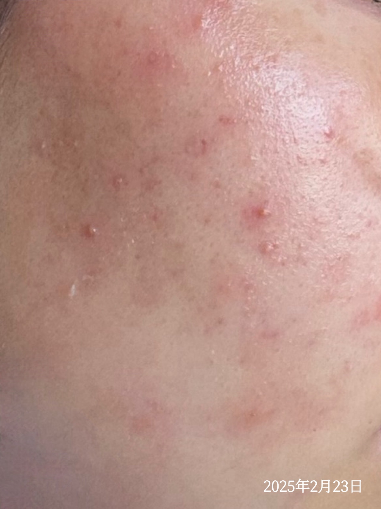 ミセラーアイメイクアップリムーバー/ビフェスタ/ポイントメイクリムーバーを使ったクチコミ（2枚目）