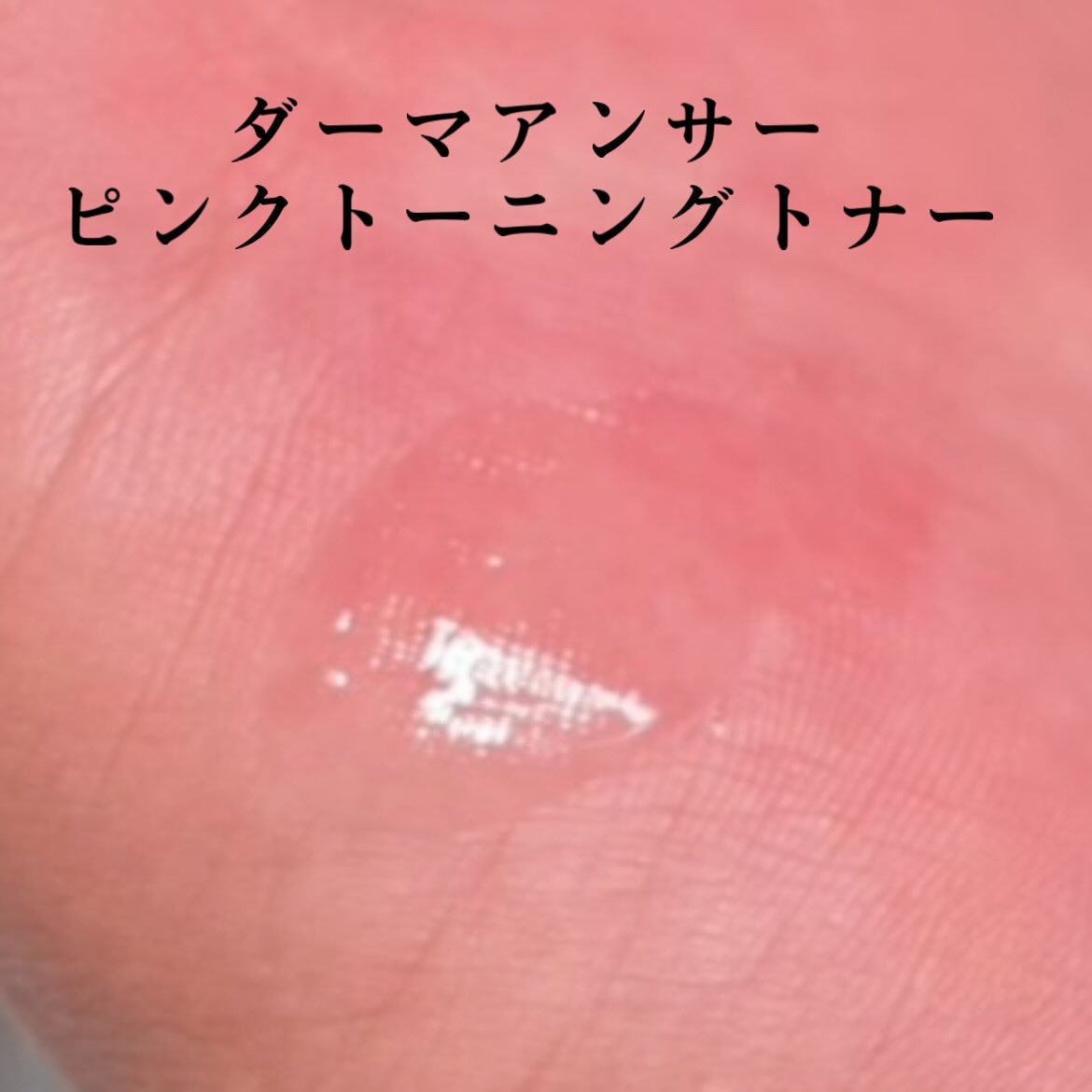 ダーマアンサーピンクトーニングトナー/CNP Laboratory/化粧水を使ったクチコミ（3枚目）