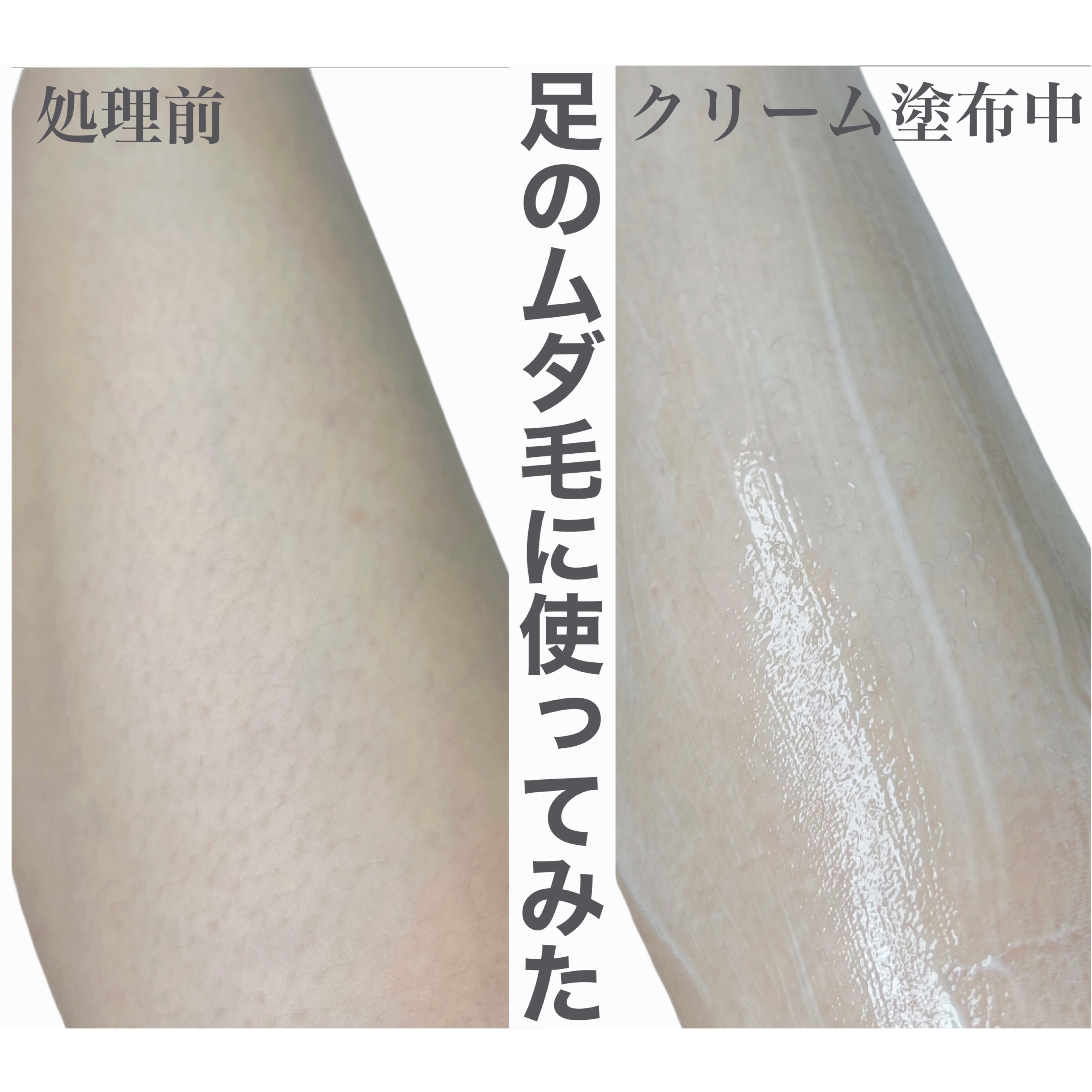 ジョモリッチ/鎌倉ライフ/除毛クリームを使ったクチコミ（3枚目）