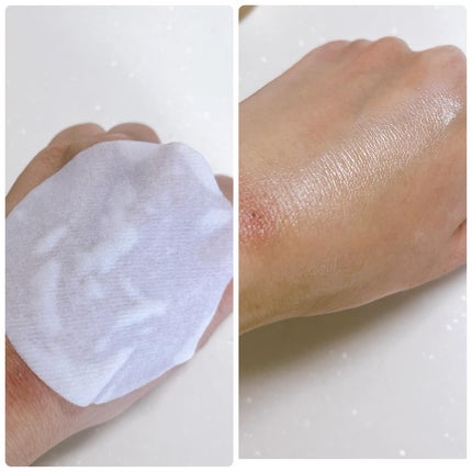 ライストナーパッド/I'm from/トナーパッドを使ったクチコミ(4枚目)