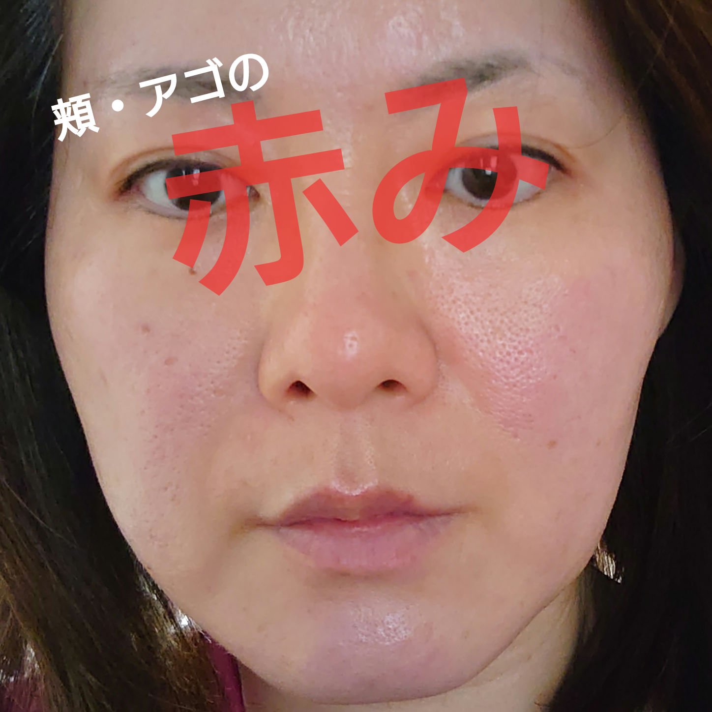 アゼライン酸16BBスージングセラム/MEDICUBE/美容液を使ったクチコミ（3枚目）