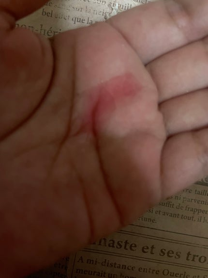 ダークスポットセラム/Anua/美容液を使ったクチコミ(3枚目)