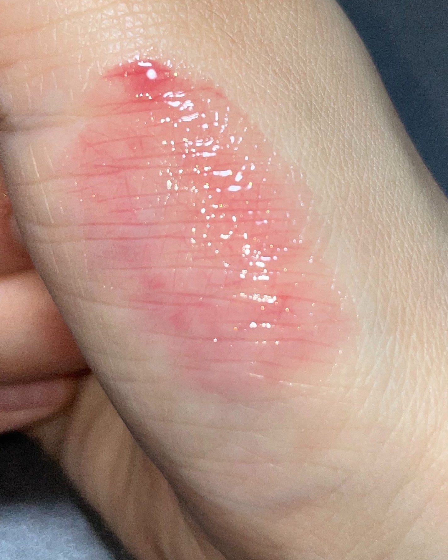 ããð€ãã©ãã on LIPS ãââ*.ïŸê§ã°ã¬ã€ãºãªãããã§ã³ãžã£ãŒê§ã¬ã€ã€ãªã³ã°ã§èªç±ã«æŒ..ãïŒ7æç®ïŒ