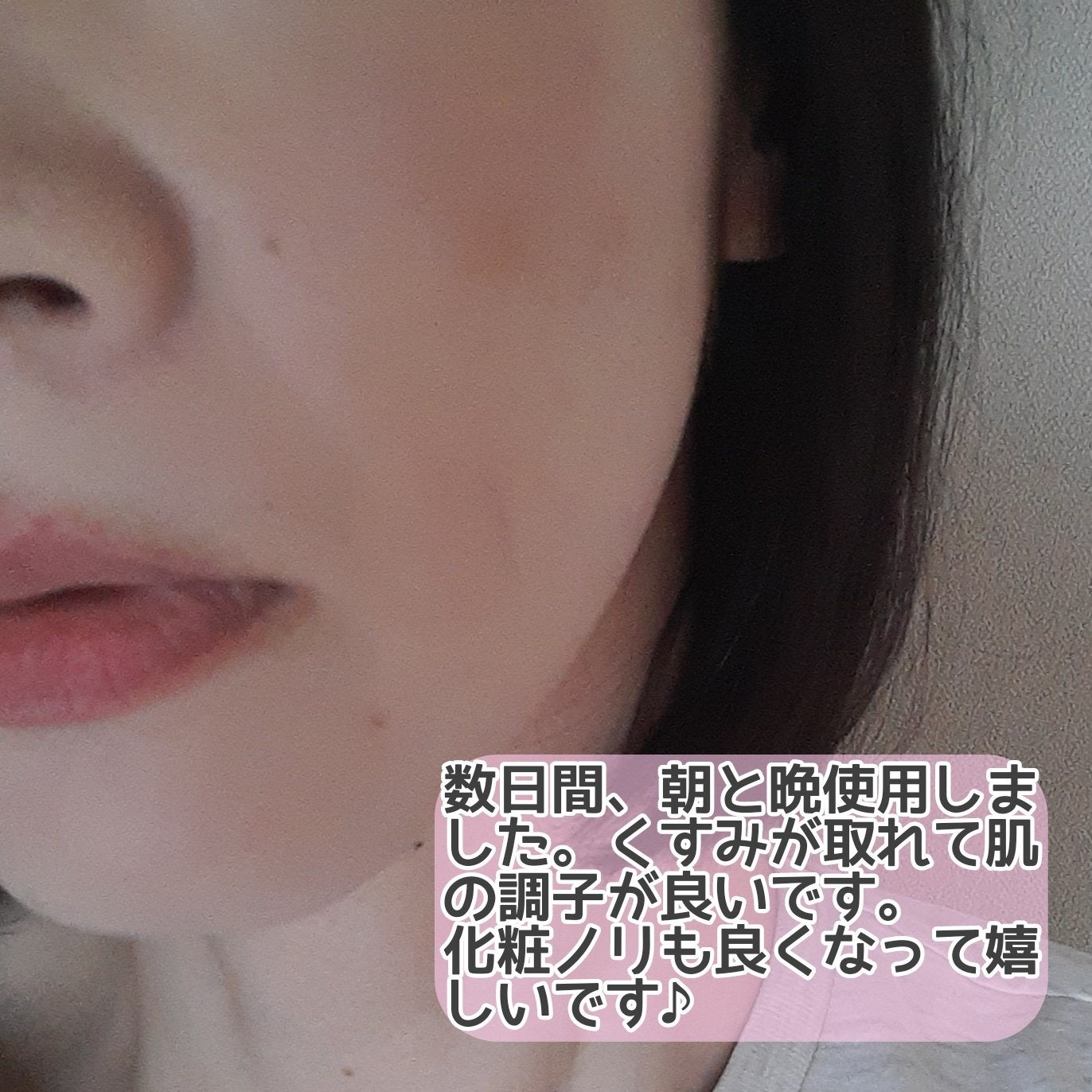 導入美容液/MOCHIYU/美容液を使ったクチコミ(5枚目)