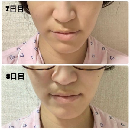 ReFa CARAT/ReFa/ボディケア美容家電を使ったクチコミ(5枚目)